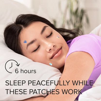 Pimple & Acne Patches - Cute, Clear & Fast-Acting