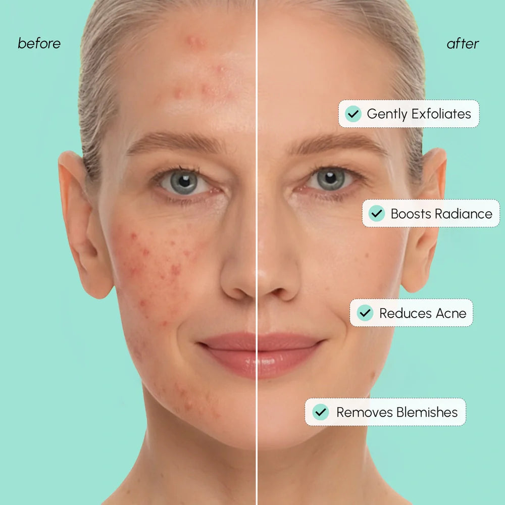Azelaic Acid Soothing Pads - Tone Balancing Facial Pads