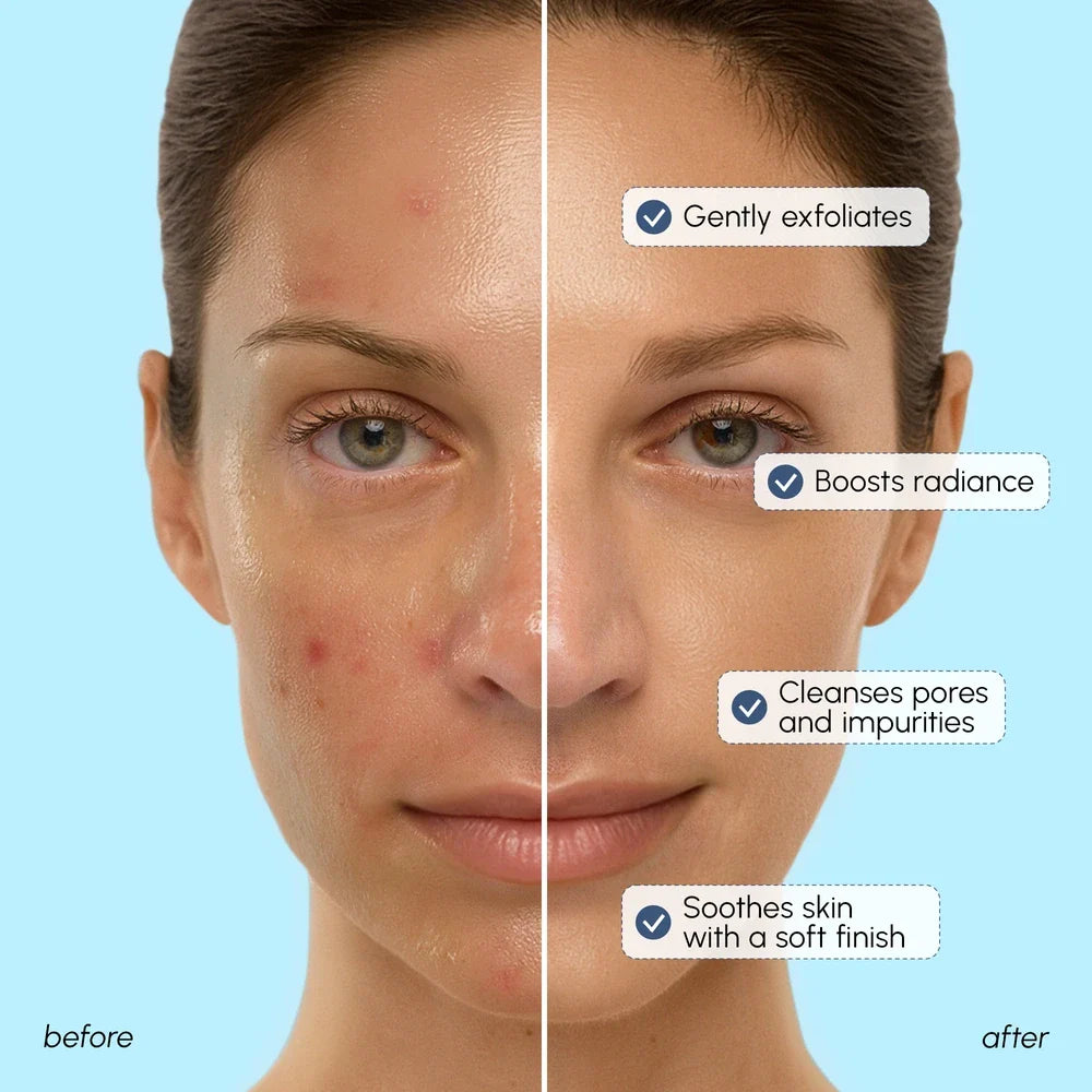 Face Polishing Scrub & Exfoliator - Glow-Boosting Skin Refiner