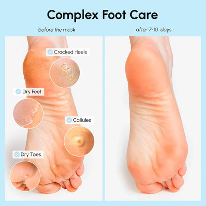 Exfoliating & Hydrating Foot Mask - Foot Peel Treatment