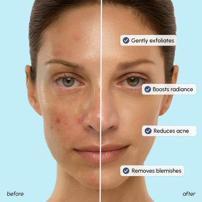 Glow Boost Glycolic Face Toner - Smooth & Radiant Skin Toner