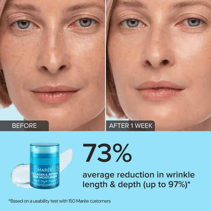 Collagen & Retinol Deep Moisturizer - Hydrating & Firming Face Cream