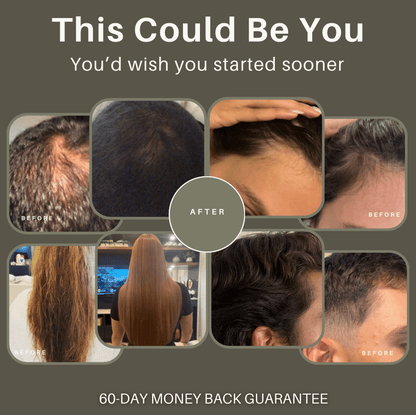 Vitality Hair Growth Oil – Organic Rosemary Scalp & Hair Elixir