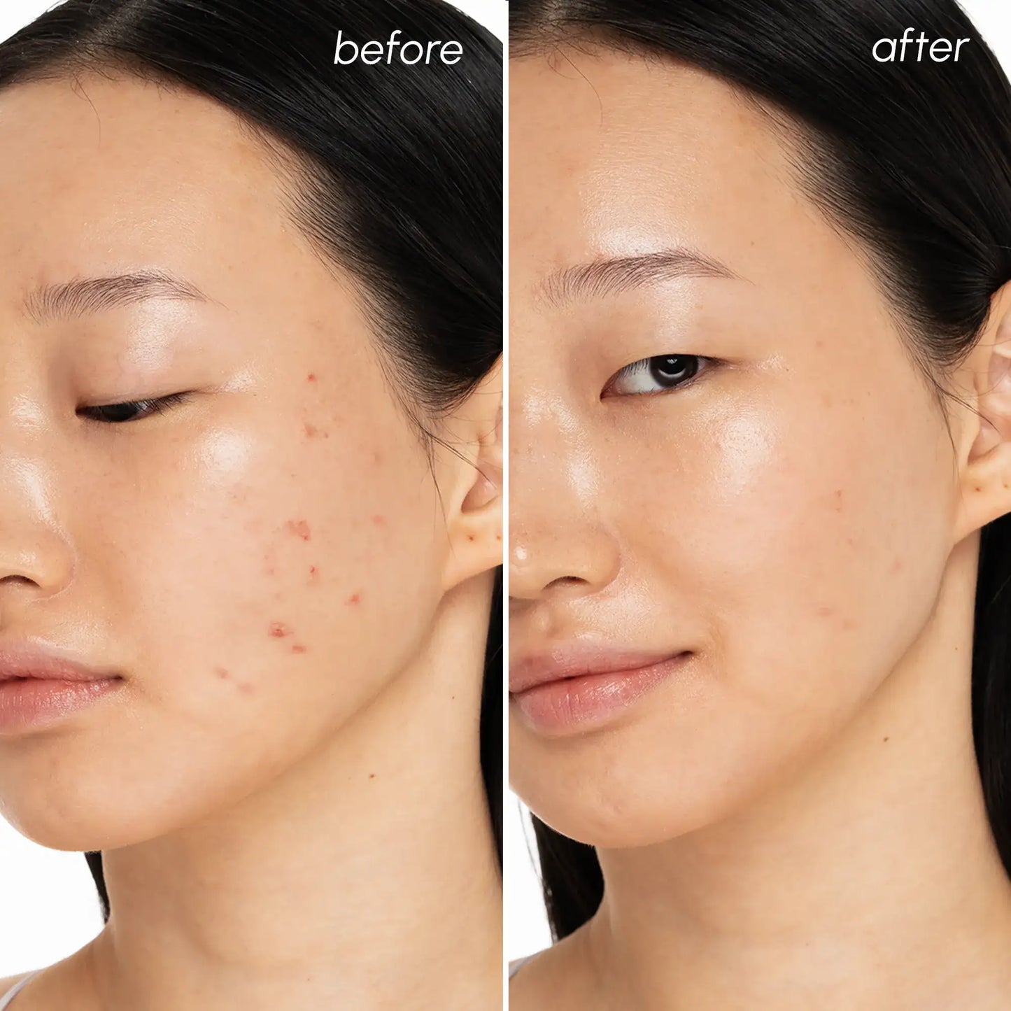 Witch Hazel Clearing Pads - Blemish & Oil Control Toner Pads