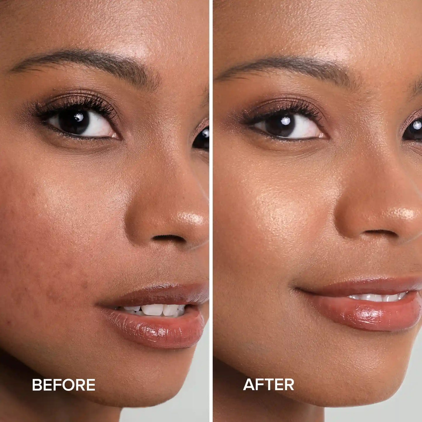 Turmeric Kojic Soap & Scrub - Brightening & Acne Clearing Bars